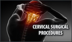 cervical-surgical-procedures-in-san-antonio